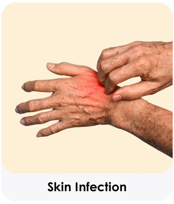 Skin Infection