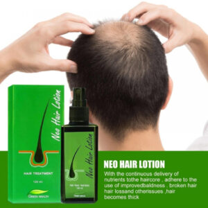 Hair Regrowth Oil For Bald Spots