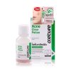 Oxecure Acne Clear Potion Fast-acting Spot Treatment For Acne-prone Skin